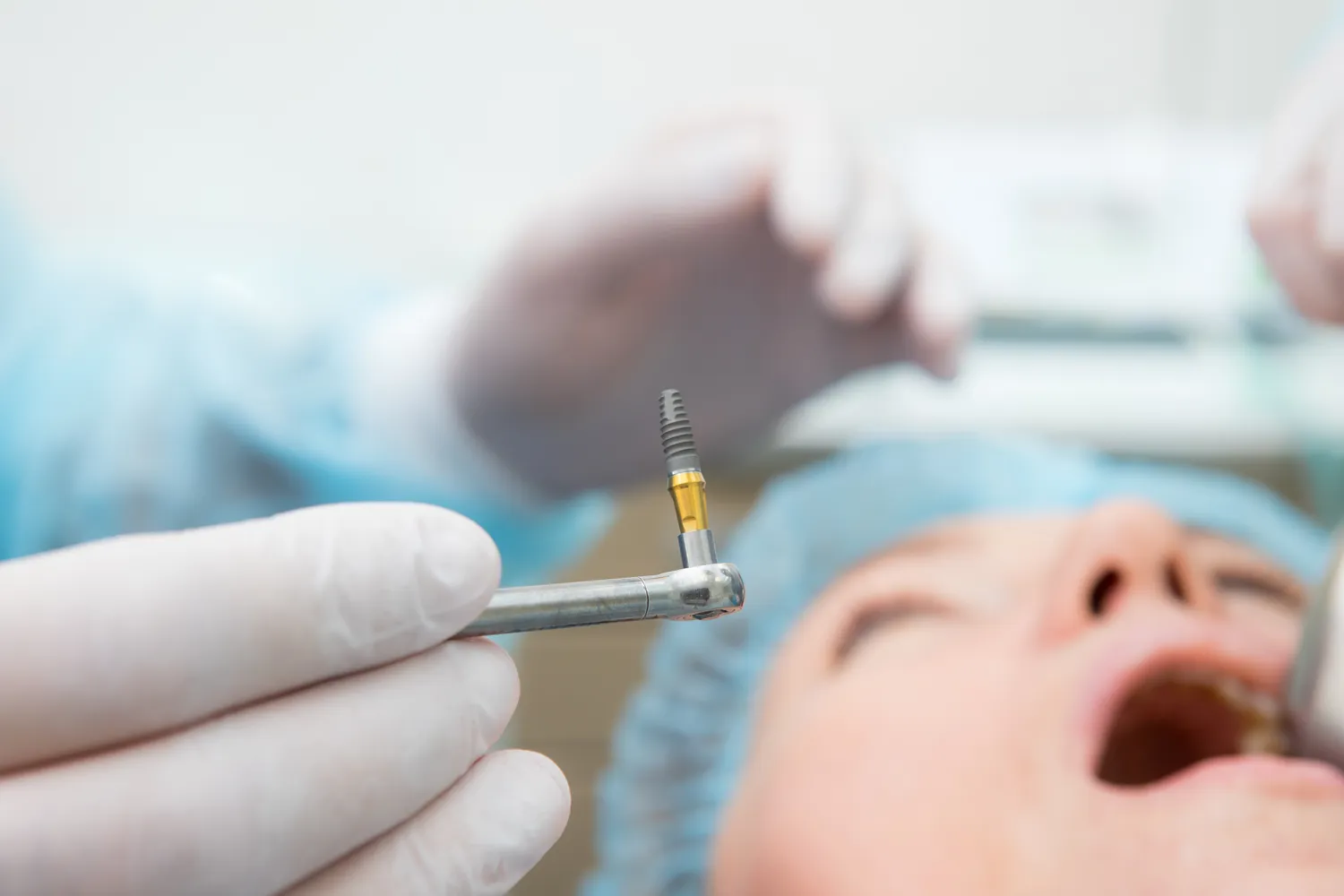 Cena implantu zeba szczecin 2